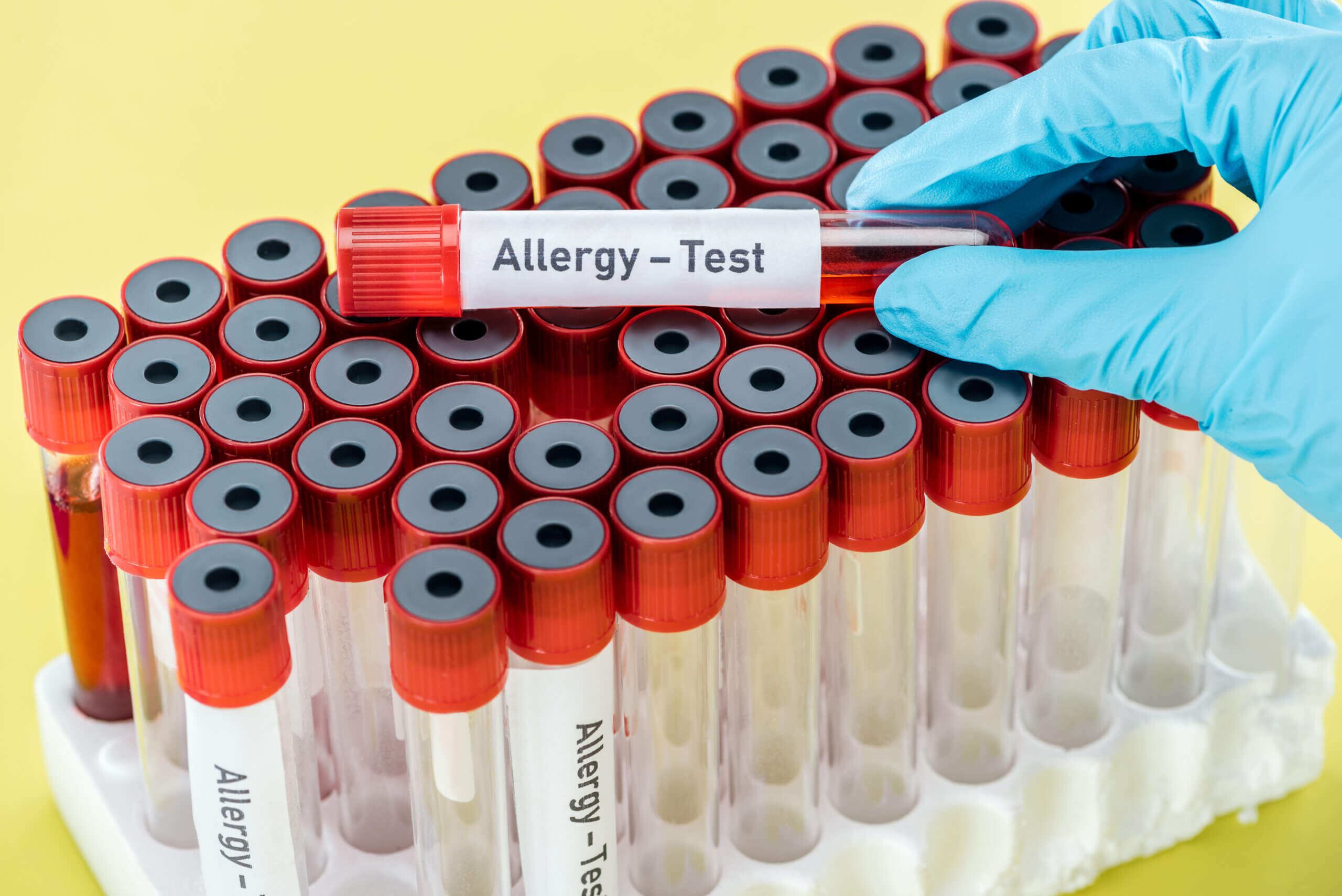 cropped view of doctor holding sample with allergy test inscription above empty test tubes isolated
