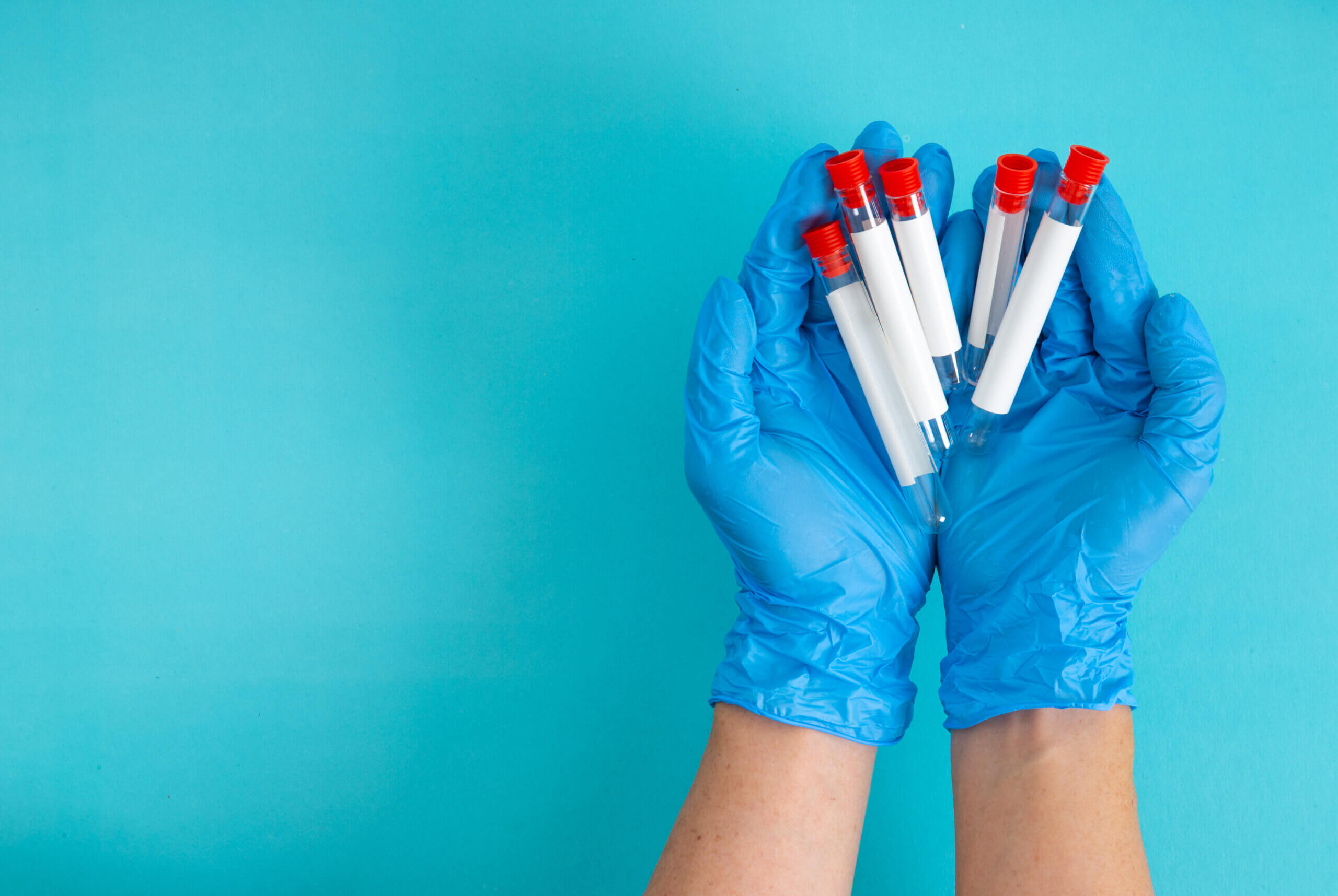 top view of doctor holding sample in test tube.